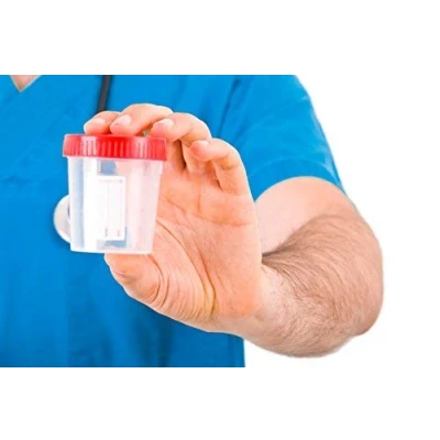 Immagine di 10 X CONTENITORI PER URINE RACCOGLITORE 125 ML TAPPO A VITE STERILE