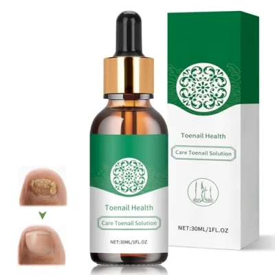 Immagine di Trattamenti per Unghie, Micosi Unghie Piedi,Trattamento Antimicotico Piedi Nutre e Lenisce Le Unghim,Rinforza la Struttura Dell&#039;Unghia, 30ml